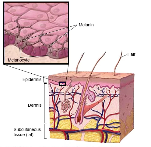 vitiligo causes