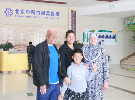 Vitiligo Patients 