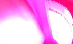 Mixed Light Therapy for Vitiligo