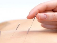 Chinese Traditional Acupuncture and Moxibustion for Vitiligo