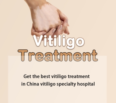 How to Cure Vitiligo Naturally 2025