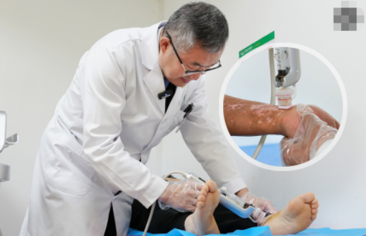 Clinical application of CGF therapy