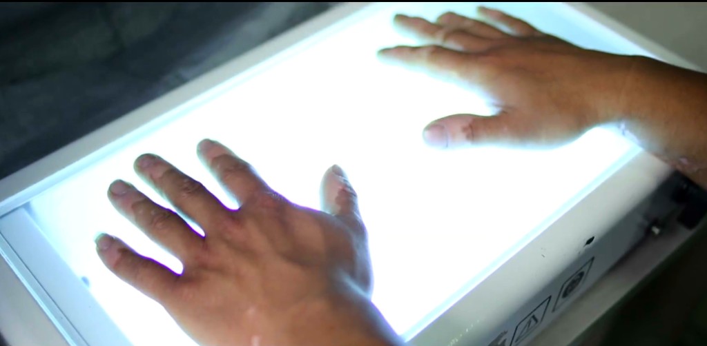 NB-UVB narrowband phototherapy treatment
